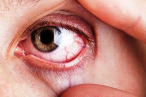 Glaucoma | Saúde Visual | Campanha reforça importância do diagnóstico precoce do glaucoma e amplia atenção à saúde visual de crianças em Feira de Santana