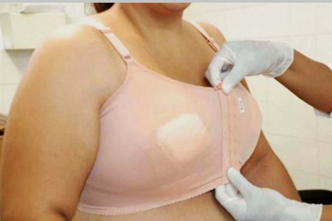 Saúde | Gigantomastia | Fundação Hospitalar fará triagem para cirurgias de gigantomastia em novembro