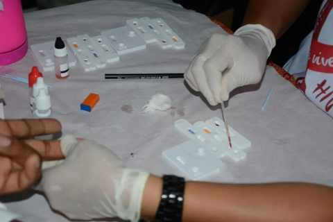 Feira de Santana | HIV | Feira de Santana registra mais de 200 novos casos de HIV/Aids em sete meses